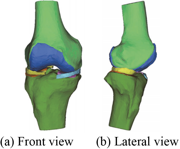 A novel 3D geometric anatomy structure optimization model of human right knee joint.