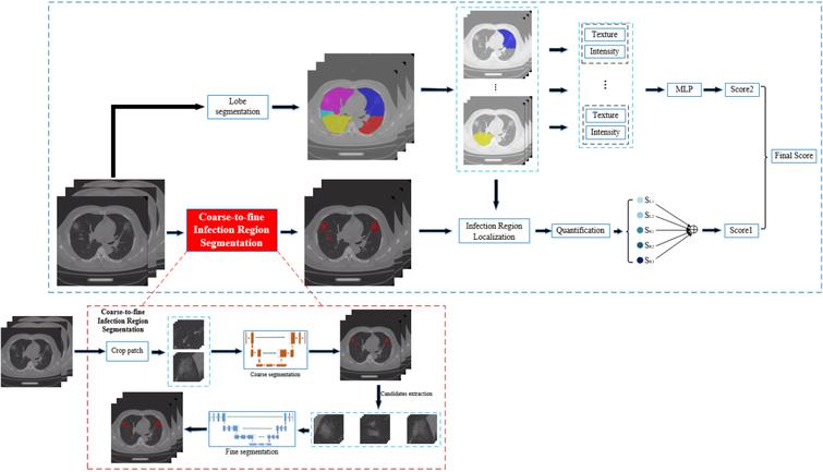 Overall model architecture of the deep learning-based CT scoring system.