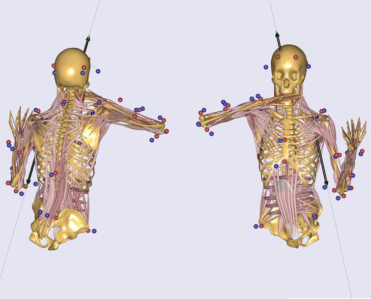 Modified AnyBody model with the black arrows as a visualization of the weight of the violin and the holding force acting on the chin and the left clavicle. Due to the rotation of the upper body while playing the violin, the black arrows are tilted in the pictures.