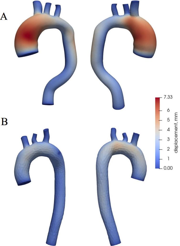 Aortic wall displacements.