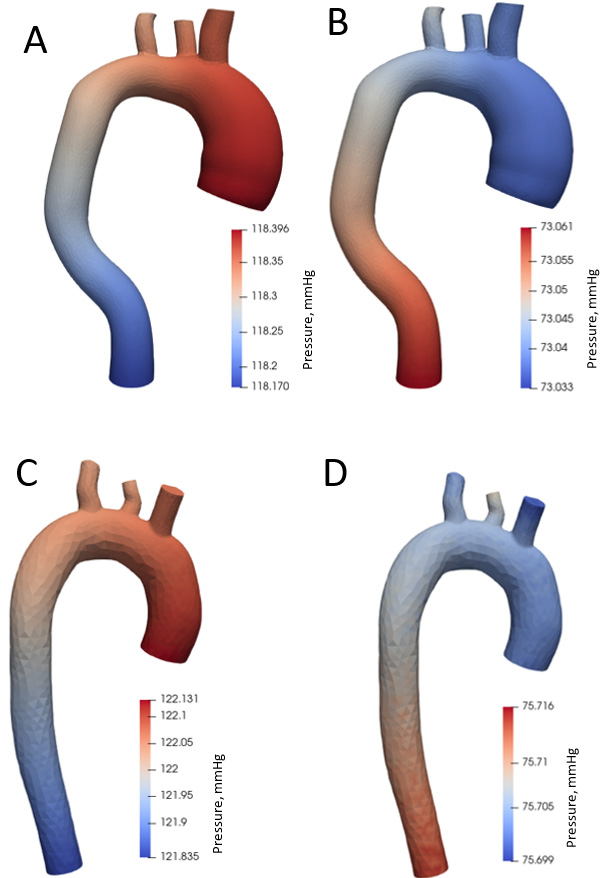 Aortic pressure distribution during systole and diastole phases.
