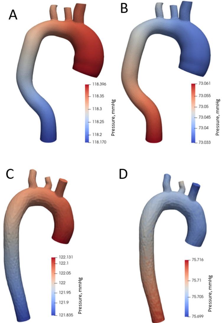 Aortic pressure distribution during systole and diastole phases.
