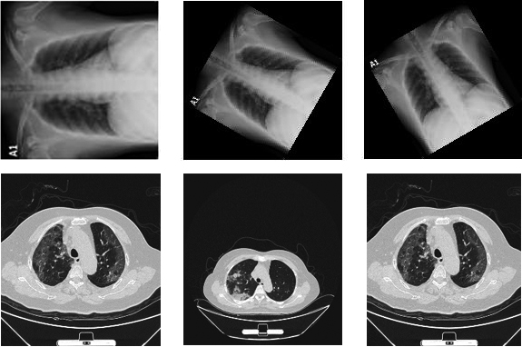 Sample images of COVID (+) infection. First row shows X-ray images and second row shows CT images.