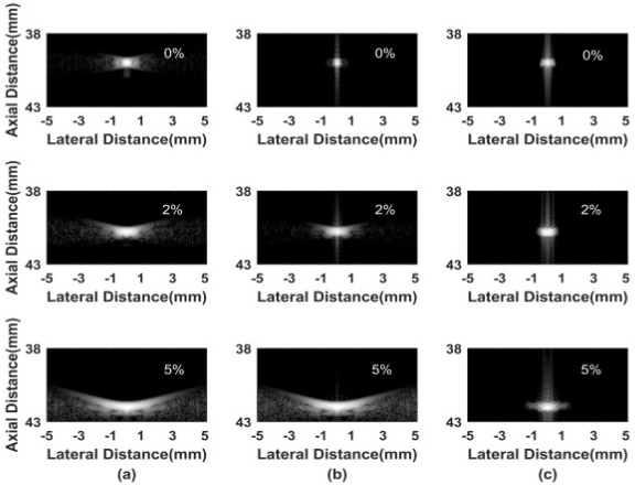 Simulated point imaging results of different sound velocity errors: (a) CPWC, (b) DCT-MV (Δ= 5), (c) SM-DCT (Δ= 0.01, p= 1). All results in the figure are displayed within a -60 dB dynamic range.