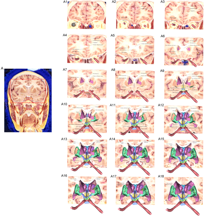 Serial coronal plane sectioned images showing contained hypothalamus and its neighboring structures that from rostral to caudal. Put one every five sheets (A1–A18), all sectioned images were cropped from the Visible Korean using Photoshop (A).