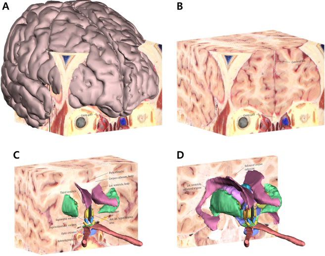 Surface models with the sectioned images in the PDF file. The surface model of the whole cerebrum with all the coronal sectioned images (A) and only the coronal sectioned images (B) can be displayed using Adobe Reader. After peeling some sectioned images, the hypothalamus and its neighboring structures appear on the rest of the sectioned images (C, D).