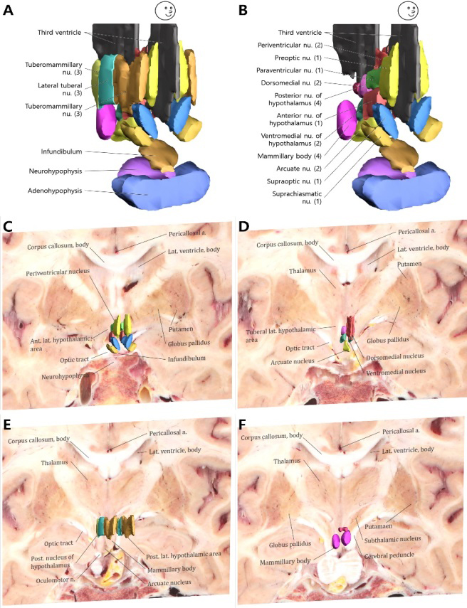 Surface models and sectioned images of the four neural zones of the hypothalamus. In only the surface models, the hypothalamic nuclei are shown with the anterior (1), intermediate (2), lateral (3), and posterior (4) hypothalamic areas (A) and without the lateral hypothalamic area (B). On the coronal plane of sectioned images with surface models, 5 nuclei in the anterior hypothalamic area (C), 4 nuclei in the intermediate hypothalamic area (D), 3 nuclei in the lateral hypothalamic area (E), and 2 nuclei in the posterior hypothalamic area (F) can be identified stereoscopically.