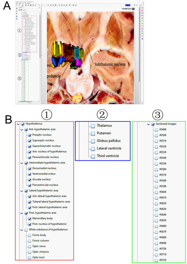 Surface models with the sectioned images and model tree. Detailed structures in the deep brain can be displayed, and affiliations of all structures can be displayed in the model tree (A), zoomed view of the model tree were displayed (B), with hypothalamus (⟀), neighboring structures (⟁) and sectioned images (⟂).