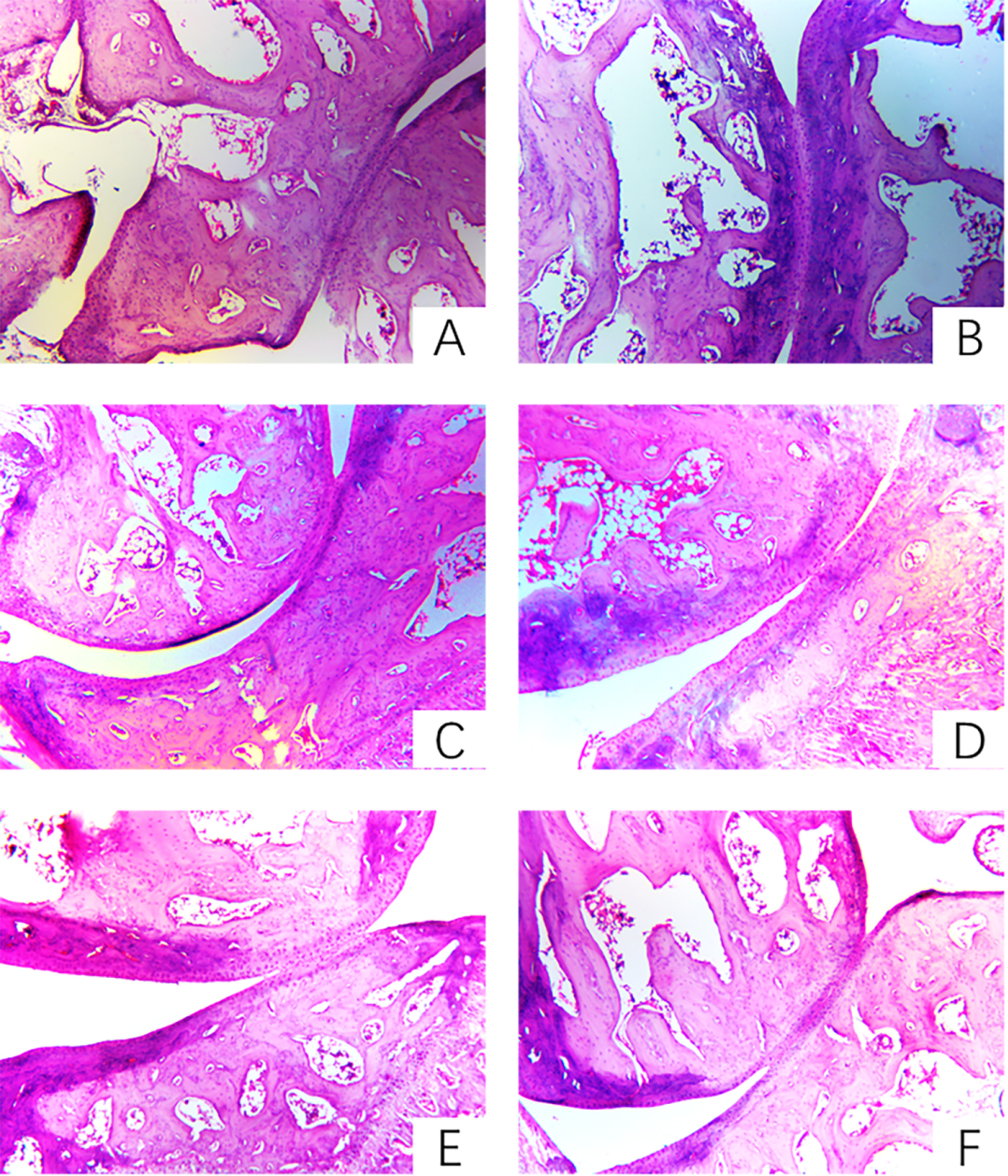 The influence of PTTTF on knee joint histopathology in rats with adjuvant arthritis(HE stain, × 200) A: Control knee joint histopathology B: Histopathological manifestations of knee joints in AA rats C: Histopathological manifestations of knee joints in AA rats treated with DXM (0.125 mg/kg) D: Histopathological manifestations of knee joints in AA rats treated with PTTTF (50 mg/mL) E: Histopathological manifestations of knee joints in AA rats treated with PTTTF (100 mg/mL) F: Histopathological manifestations of knee joints in AA rats treated with PTTTF (200 mg/mL)