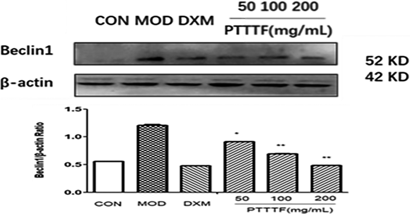 The influence of PTTTF on Becinl1 expression in synovium of adjuvant arthritis rats. The number of samples in each group was 10. All data stand for the mean ± SD. Compared with model group, P*< 0.05, P**< 0.01. CON: Control group, MOD: Model group, DXM: Positive group.
