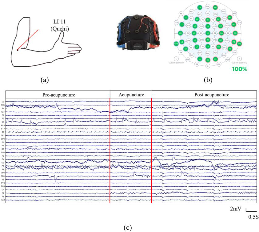 The locations of LI 11 and the EEG recording. (a) Locations of LI 11. (b) Emotiv EPOC EEG headset and (c) the EEG signals recorded. EEGs were recorded before (Pre-acupuncture), during (Acupuncture) and after acupuncture (Post-acupuncture).