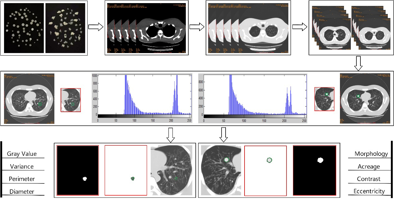 Algorithm flow of intelligent analysis model of pulmonary nodules.