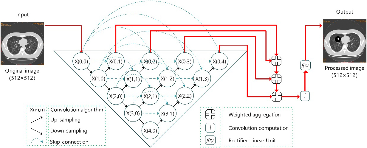 U-Net++ segmentation model based on feature weighted integration.