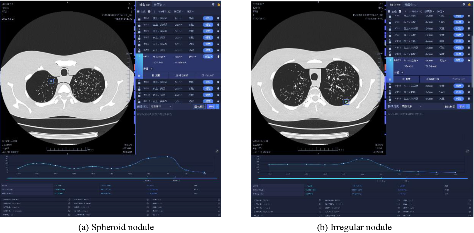 AI recognition of pulmonary nodules in different types of CT images.