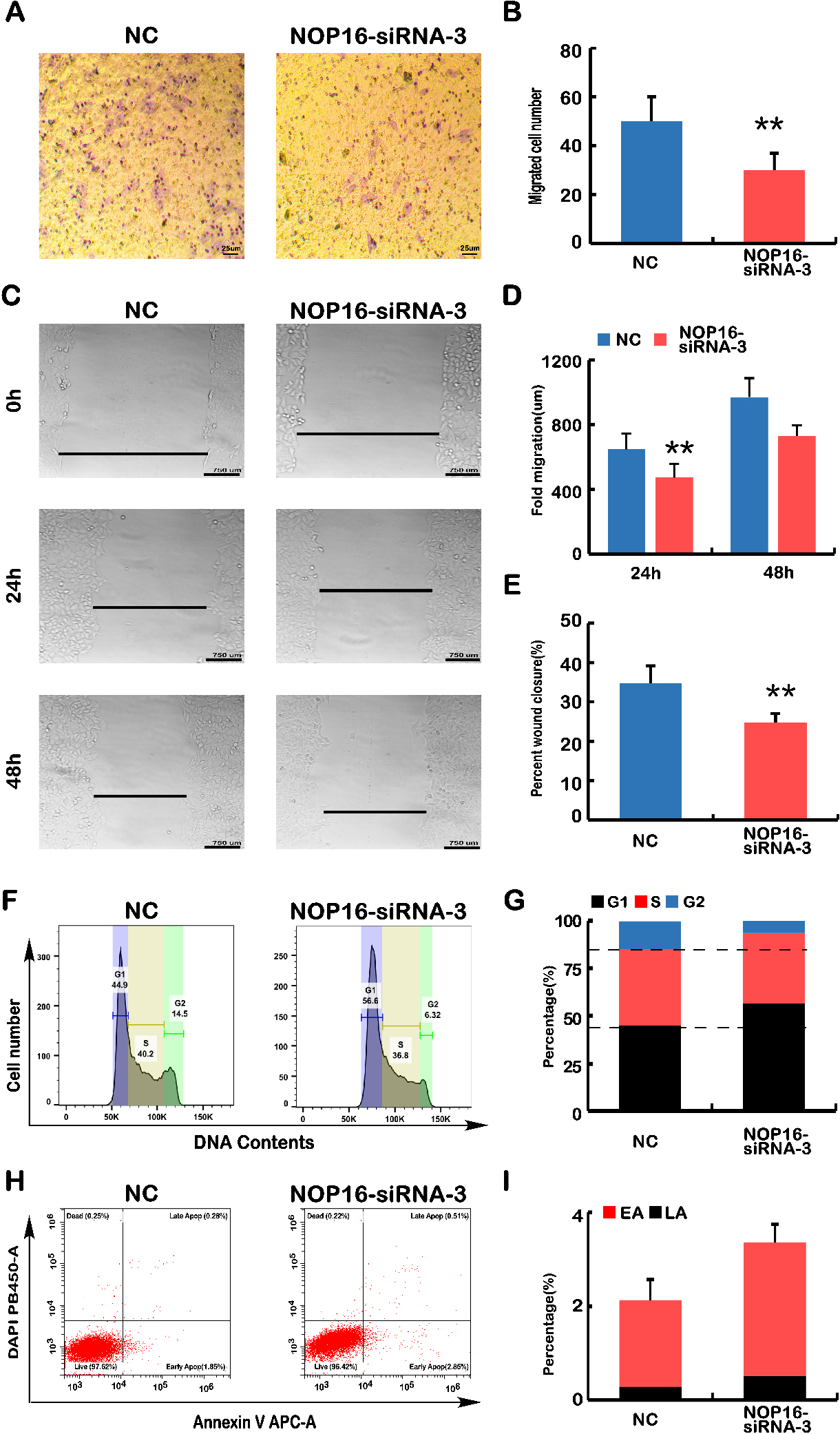 Analyses of cell migration, wound healing, cell cycle and apoptosis. (A) Transwell migration assays. The polycarbonate film stained with crystal violet was photographed on an inverted microscope. The number of cells that migrated across the membrane in NC and NOP16-siRNA-3 cells was calculated. (B) The number of infected cells in each NC and NOP16-siRNA-3 cell line was calculated according to the infected cell chart in Fig. A. (C–E) Wound healing assay. (C) NC and NOP16-siRNA-3 cells covering the bottom of the small dish were scratched with the tip of 10 μL pipette, and the healing of each cell line was recorded at 0 h, 24 h and 48 h using inverted microscopy. Pictures show representative examples. Scale bars, 750 μm. (D) According to the scratch width in Fig. C, the cell migration distance of each cell line was calculated at 24 h and 48 h. (E) According to the scratch, the cell mobility of each cell was calculated at 24 h and 48 h. (F) Cell cycle detected using flow cytometry. Cell number distribution maps of NC and NOP16-siRNA-3 cell lines at each stage of the cell cycle were detected using flow cytometry. (G) The percentage of NC and NOP16-siRNA-3 cell lines in G0/G1, S and G2/M phases was calculated. (H) Cell apoptosis was detected using flow cytometry. Cell apoptosis of NC and NOP16-siRNA-3 cell lines was detected using flow cytometry. The cells were divided into four zones: “Dead”, “Late Apop”, “Early Apop” and “Live”. (I) It was used to calculate the percentage of apoptotic cells in NC and NOP16-siRNA-3 cells. “LA” refers to Late Apop, and “EA” refers to Early Apop. N⩾ 3, and “**” “$ $” indicates p⩽ 0.01.