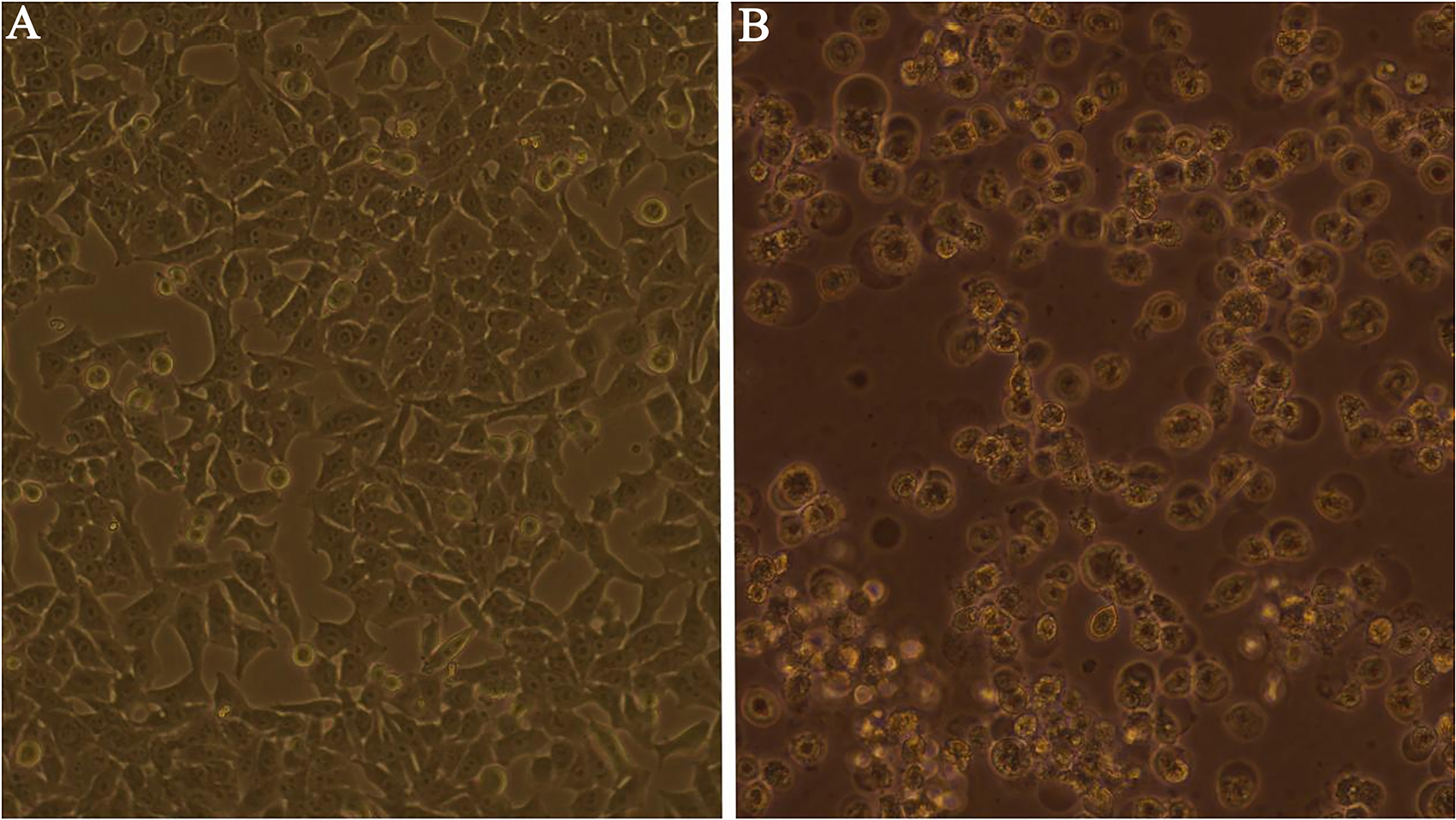 Isolation of adenoviruses in Hep-2 cells vs. negative control. A: Negative control (10×). B: Emergence of CPE following inoculation into Hep-2 (10×).