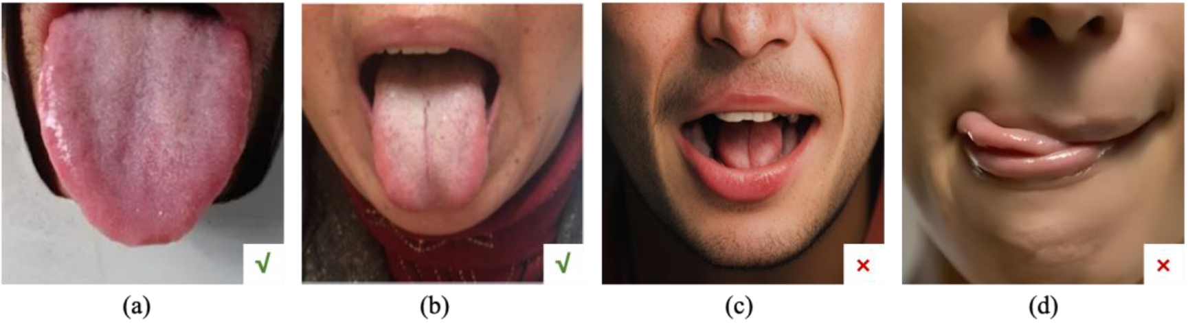 Common tongue images, where (a) and (b) are qualified tongue images, and the tongues in (c) and (d) are not extended, rendering them unqualified.