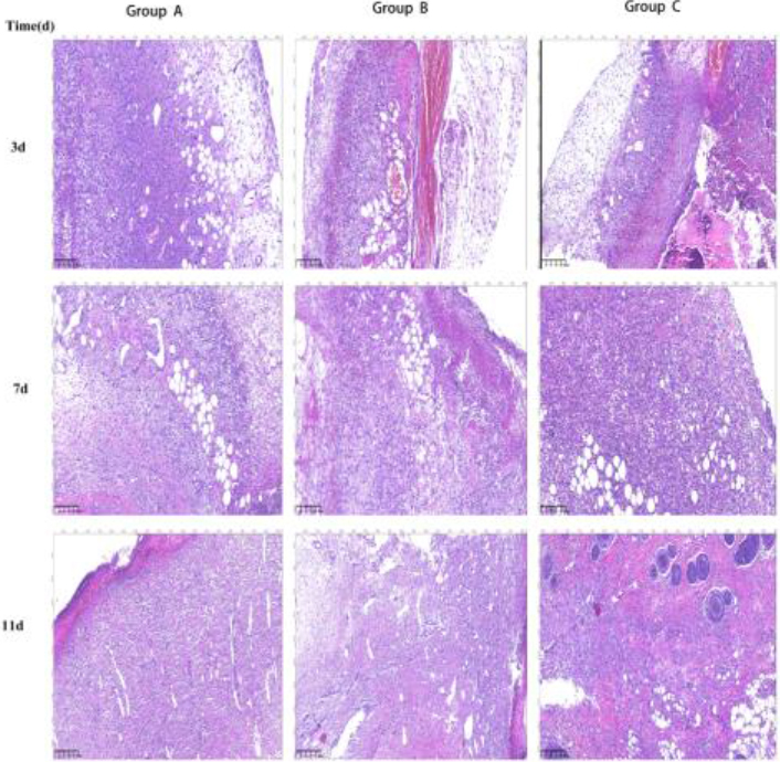 Wound healing at different time intervals in different groups. Group A is the normal control group, Group B is the EGF group, and Group C is ELF-EMF+EGF group. 