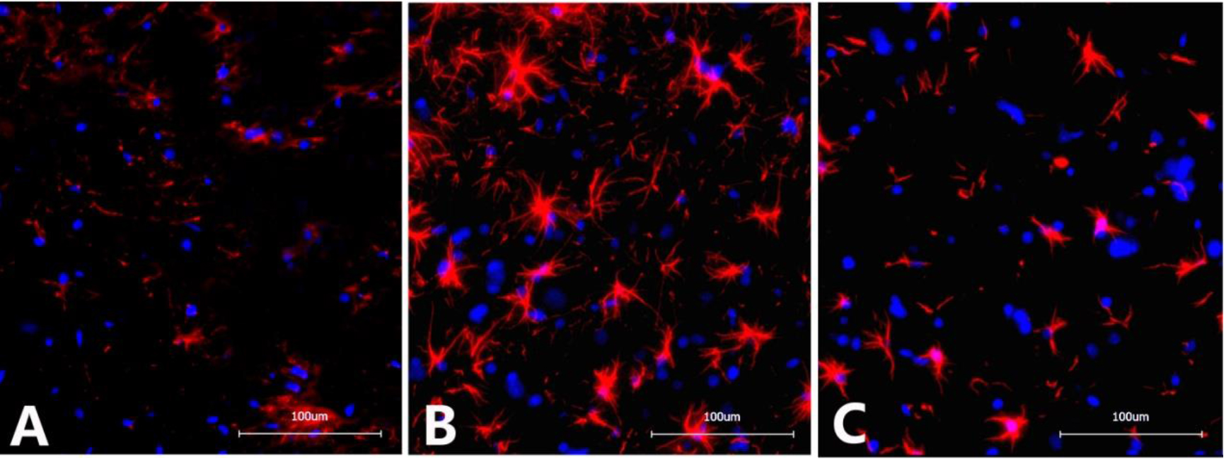  Immunofluorescence images of GFAP in the dorsal horn of the L6-S1 spinal cord in different groups of rats. A. Sham operation group: Scattered expression of GFAP with small, inconspicuous cell bodies with slender protrusions and lightly stained chromosomes; B. NBP model group: Significantly increased GFAP expression with apparently enlarged cell bodies with thickened and elongated protrusions and darkly stained chromosomes; C. NBP+intrathecal BNP injection group: GFAP expression was reduced compared with the NBP model group. Magnification at 200x. 