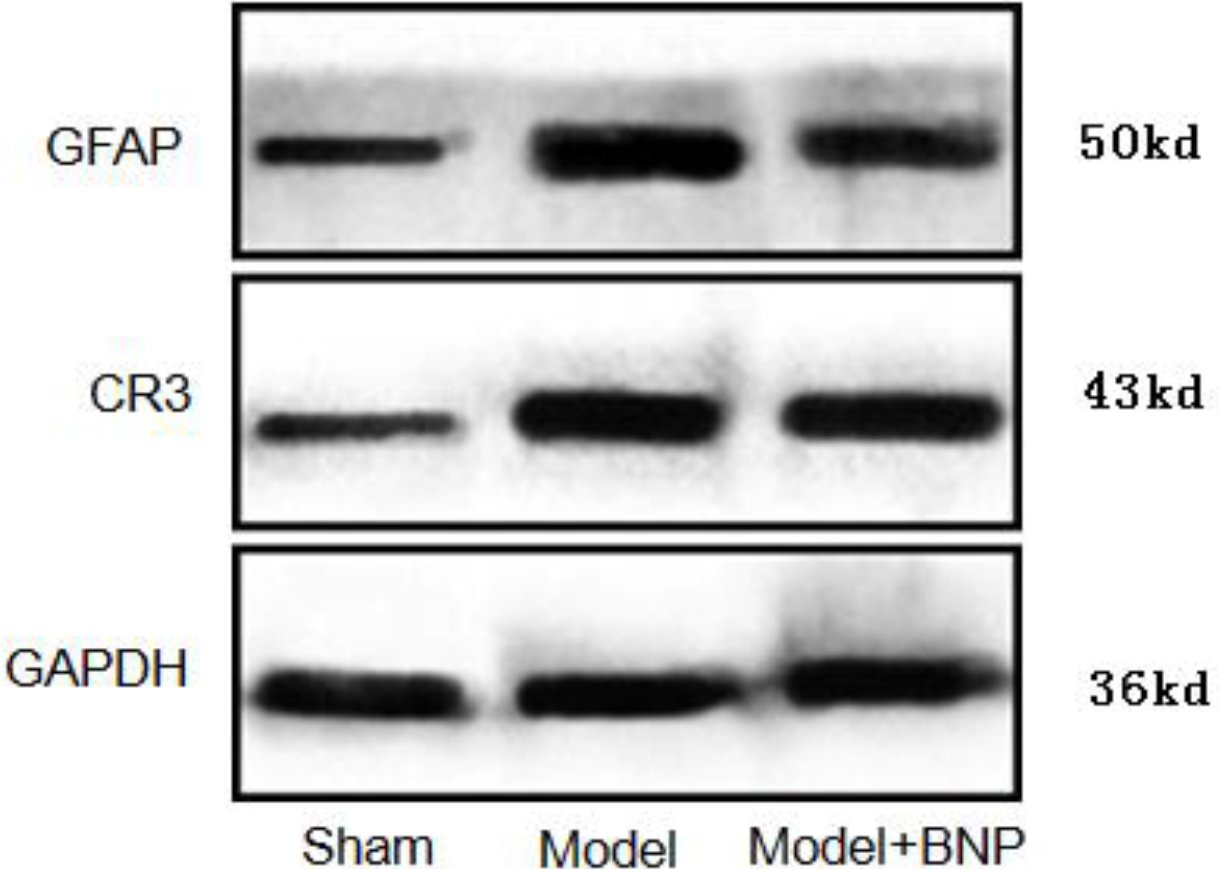 Expression of GFAP and CR3/CD11B in the dorsal horn of the L6-S1 spinal cord in different groups of rats.