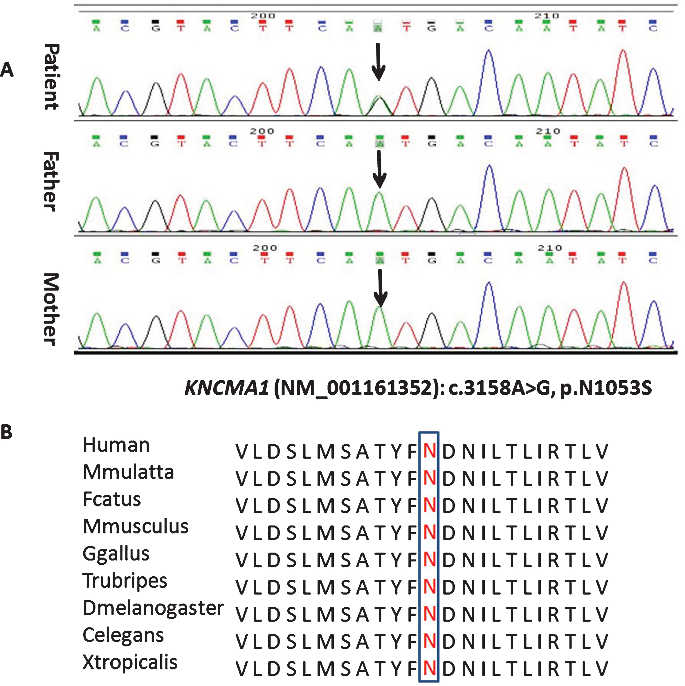 Sequence chromatogram showing one base pair substitution in KCNMA1 gene (A) and conservation of the altered amino acid shown in the ClustalW alignments (B).