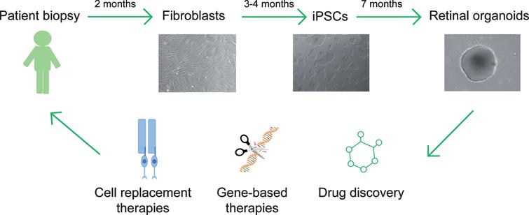Translational therapeutics using patient iPSC-derived retinal organoids. Patient fibroblasts are obtained from skin biopsy samples and subsequently reprogramed to generate induced pluripotent stem cells (iPSCs). Retinal organoids can be differentiated from iPSCs and applied as a cell source to replace dysfunctional or dead photoreceptors in retinal ciliopathy patients, or as an in vitro platform to evaluate gene-based treatments or drug candidates.