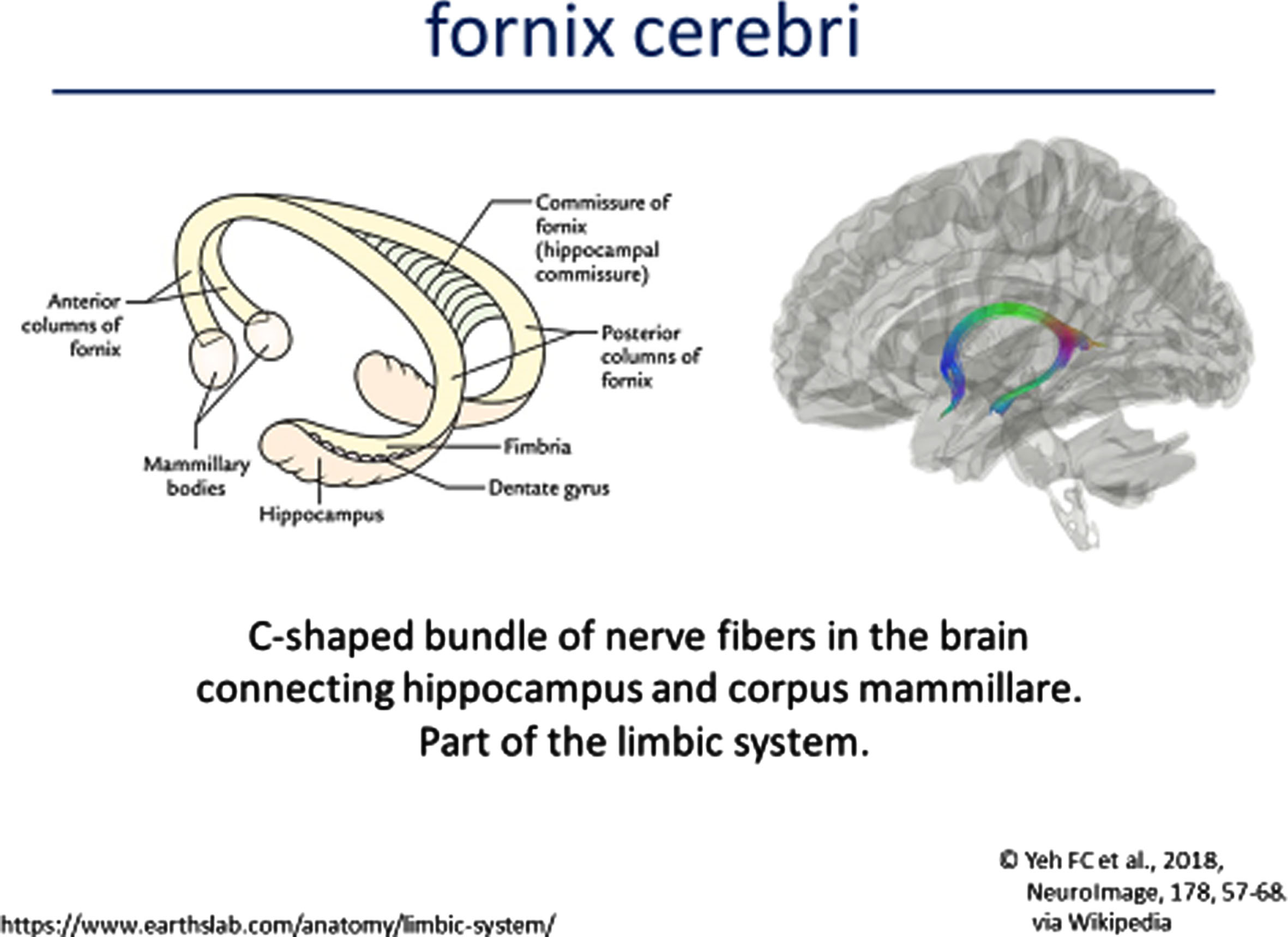 MRI Features of FOXG1 Disorder: Fornix Cerebri.