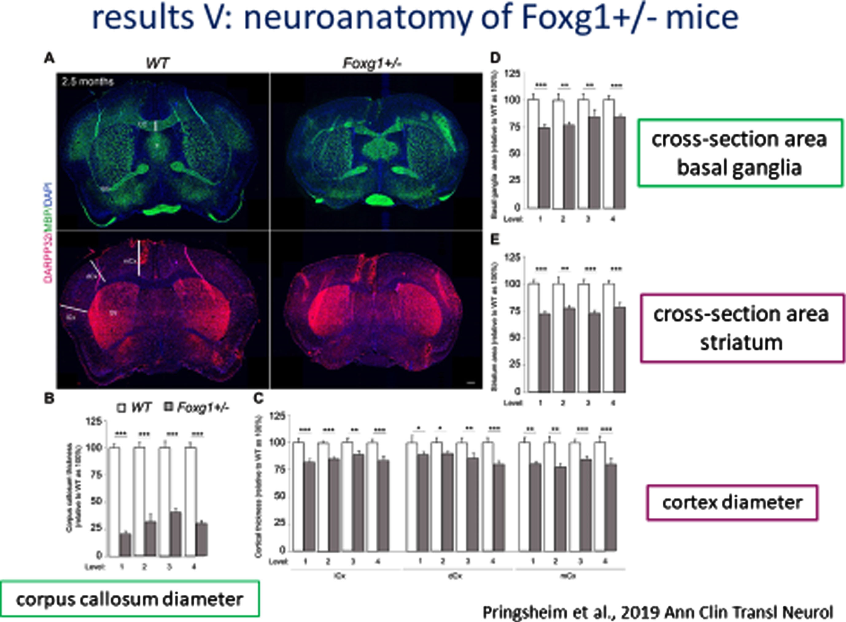 Neuroanatomy of FOXG1 Mouse Model: Cross-sectional area of Basal Ganglia and Striatum and Diameter of Cortex.