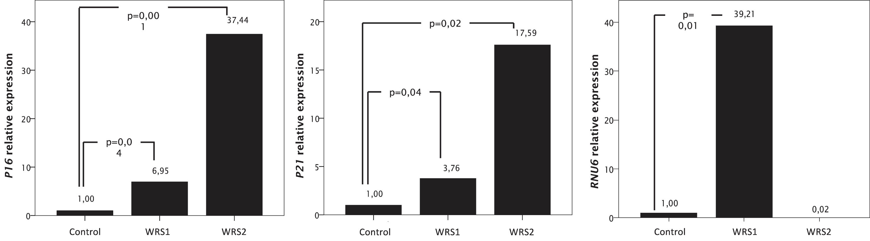 mRNA relative expression of genes related with cellular senescence (P16 and P21), and RNU6, one of the transcripts of the RNA Polymerase III, measured by RT-PCR in WRS and control fibroblasts. Data were normalized to GAPDH expression for the P16 and P21 expression and to RNU48 for the RNU6 expression. Increased expression of RNU6 in WRS1 cells compared to control cells diminished the expression of genes related to cellular senescence.