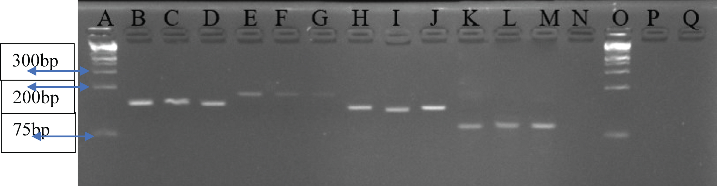 A 4% Agarose gel analysis for selected amplicons of qRT-PCR products per gene. Lane A and O – 1 kb plus Ladder; Lanes B, C, D – GAPDH (139 kb); Lanes E, F, G – CASP9 (172 bp); Lanes H, I, J – CXCR2 (131 bp); Lanes K, L, M – CXCL1 (90 bp); N – Negative control.