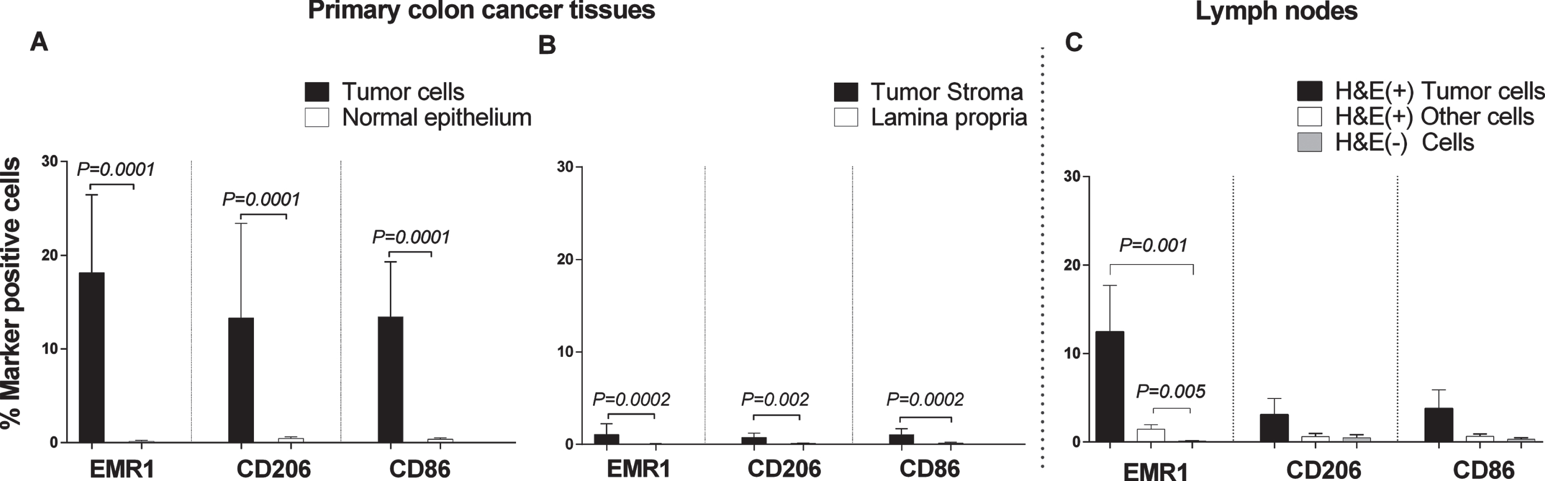 Frequencies of EMR1, CD206 and CD86 positively stained cells in CC primary tumor tissue compared to normal colon tissue, and in H&E(+) and H&E(–) lymph nodes from CC patients as determined by immunomorphometric analysis according to Weibel. (A) CC tumor cells (black bars) compared with normal epithelial cells (open bars). (B) CC tumor stroma (black bars) compared with lamina propria in normal colon (open bars). (C) Metastatic tumors cells (black bars) and other cells of H&E(+) lymph nodes (open bars) compared to cells of H&E(–) lymph nodes (grey bars). Bars represent mean+1 SEM. P-values for comparisons between tumor and normal tissue by two-sided Mann–Whitney t-test are given. Ten primary CC tumors and 9 normal colon tissue samples were analyzed in A and B. Thirteen lymph nodes were analyzed in C.