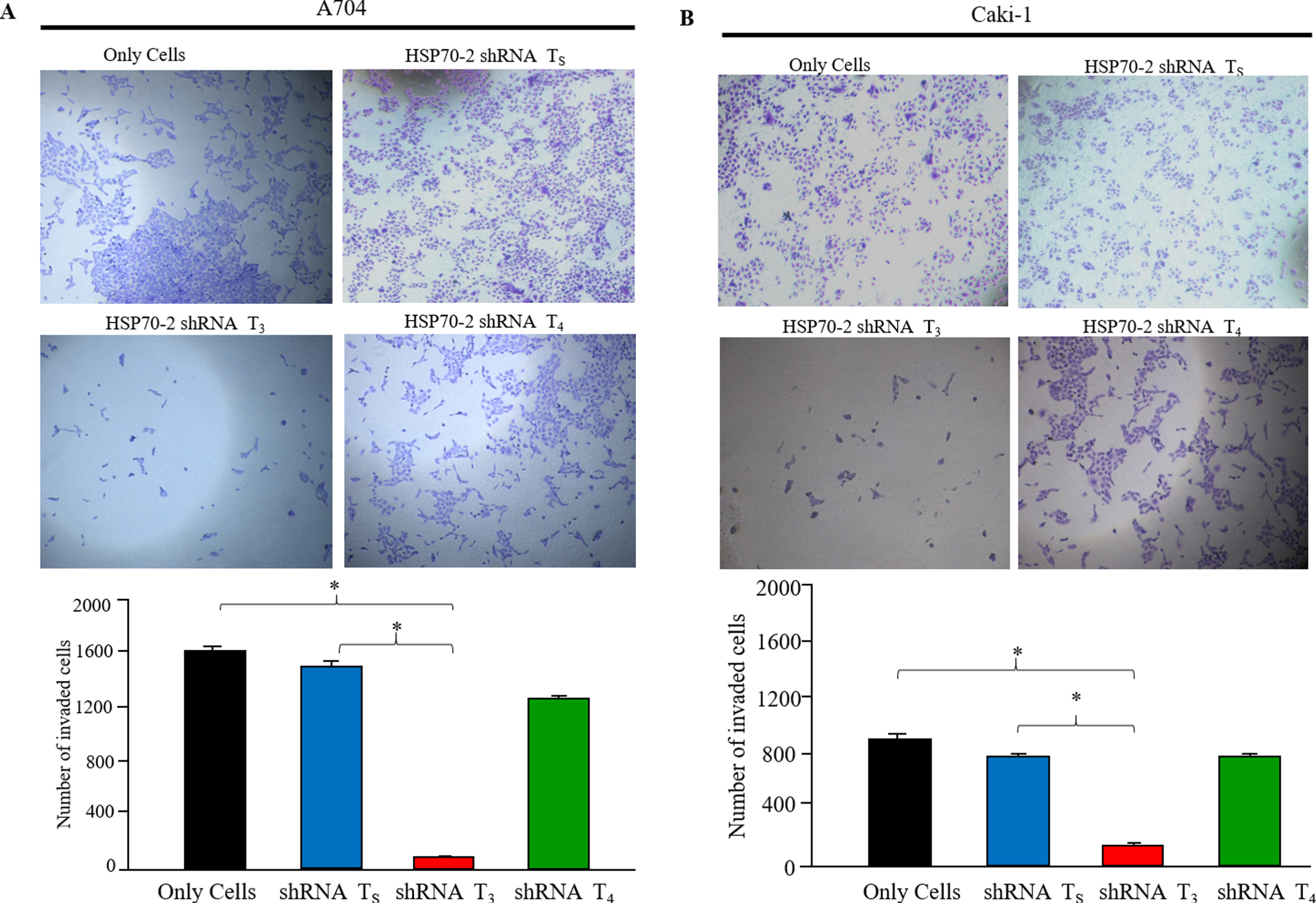 HSP70-2 knockdown inhibits the invasive property of RCC cells. Invasion assay were carried out in A704 and Caki-1 cells by transient transfection using HSP70-2 shRNA T3 or shRNA T4 or shRNA TS. (a) A704 and (b) Caki-1 cells showing reduction in number of invaded cells when transfected with HSP70-2 shRNA T3 as compared to the cells transfected with shRNA T4 or shRNA TS. However only cells failed to show any significant inhibition in invasive property of cancer cells. Representative histogram revealed significant reduction in number of invaded cells when transfected with shRNA T3 as compared to cells transfected with shRNA TS or shRNA T4 or only cells. n = 3 independent experiments; each experiment was performed in triplicate. Points, mean; bars, SE. statistical significance  *, P <  #x003C;<  #x200A;0.0001.
