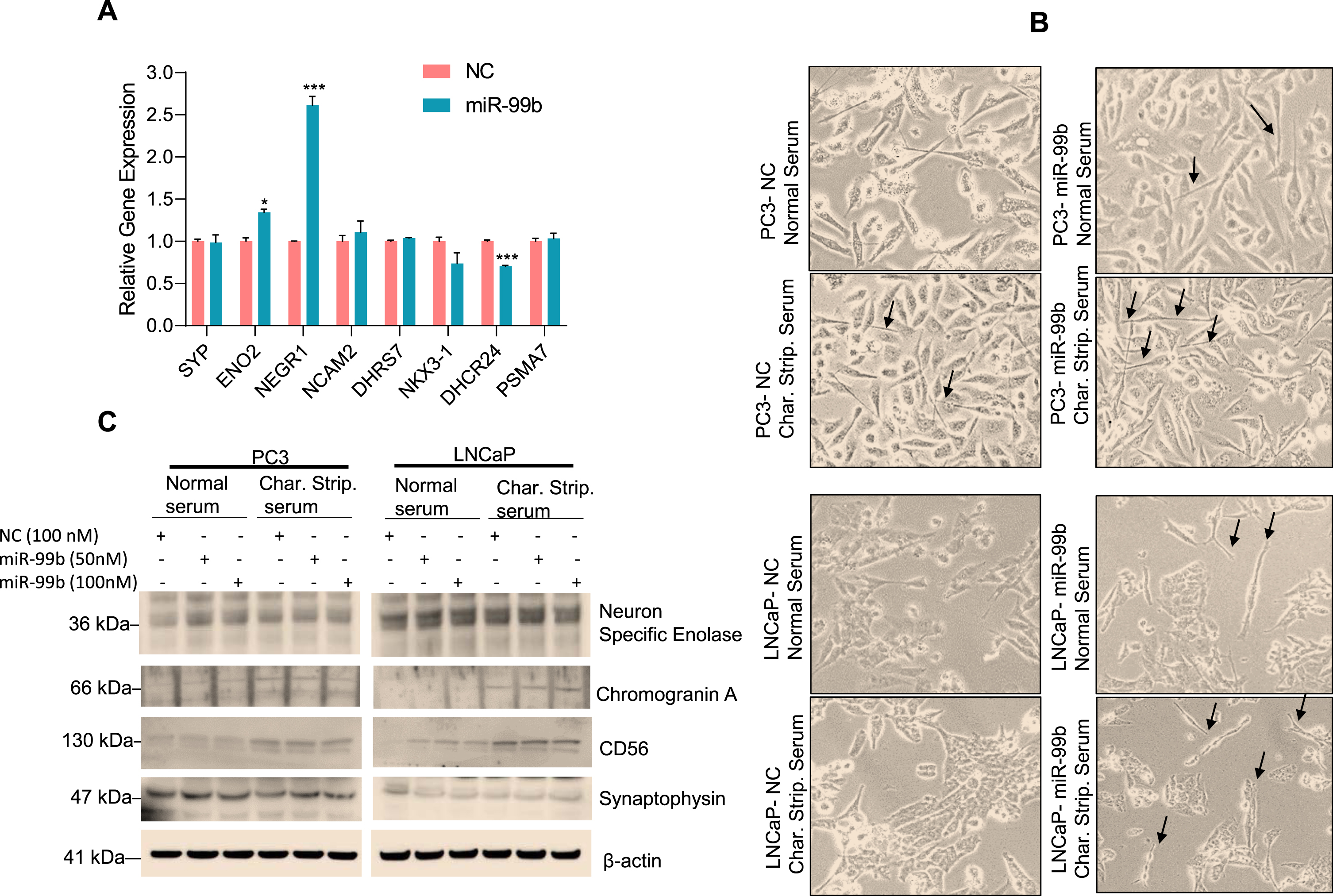 miR-99b induces NED marker expression in PC3 and LNCaP cells (A) PC3 cells were transfected with NC of miR-99b for 24 h in triplicate and the effect of overexpression of miR-99b on the regulation of NED markers expression in PC3 cells were analyzed by RNA-seq. *P < 0.05, ***P < 0.001 compared with NC transfected PC3 cells. (B) PCa PC3 and LNCaP cells were grown in normal serum or charcoal-stripped serum and transfected with NC or miR-99b mimic (100 nM) for 48 h. Cells were observed under a microscope and photographed. (C) Similarly, PC3 and LNCaP cells were grown in normal serum or charcoal-stripped serum and transfected with NC or miR-99b mimic for 48 h and cell lysates were immunoblotted with indicated antibodies.