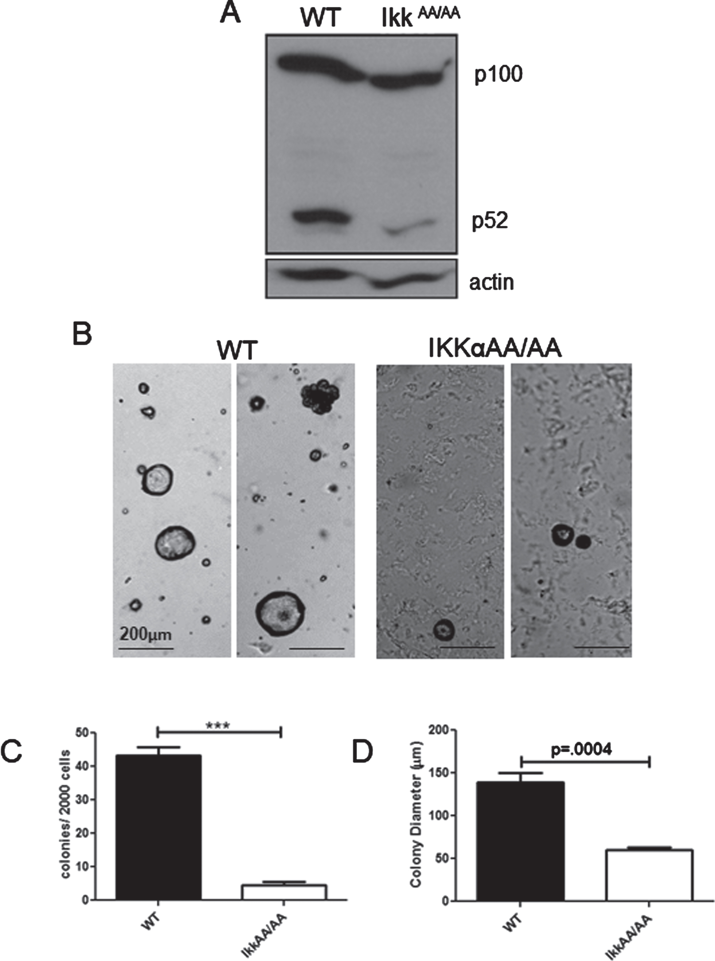 Attenuated colony formation by IkkαAA/AA mammary cells: A, Whole mammary glands from virgin WT and IkkαAA/AA mice were isolated and protein extracts immunoblotted to detect p100/p52. Actin was used as a loading control. B, WT and IkkαAA/AA mammary glands were isolated from 3 each 7-8 week old mice and linneg cells were subjected to Matrigel colony formation assays. Examples of luminal and basal (arrow) colonies are shown form both mice. Bars are 200μm. C, Colonies per 2000 seeded cells were counted and D, colony diameters measured. Statistical analyses: unpaired t-tests ***p < 0.0001.