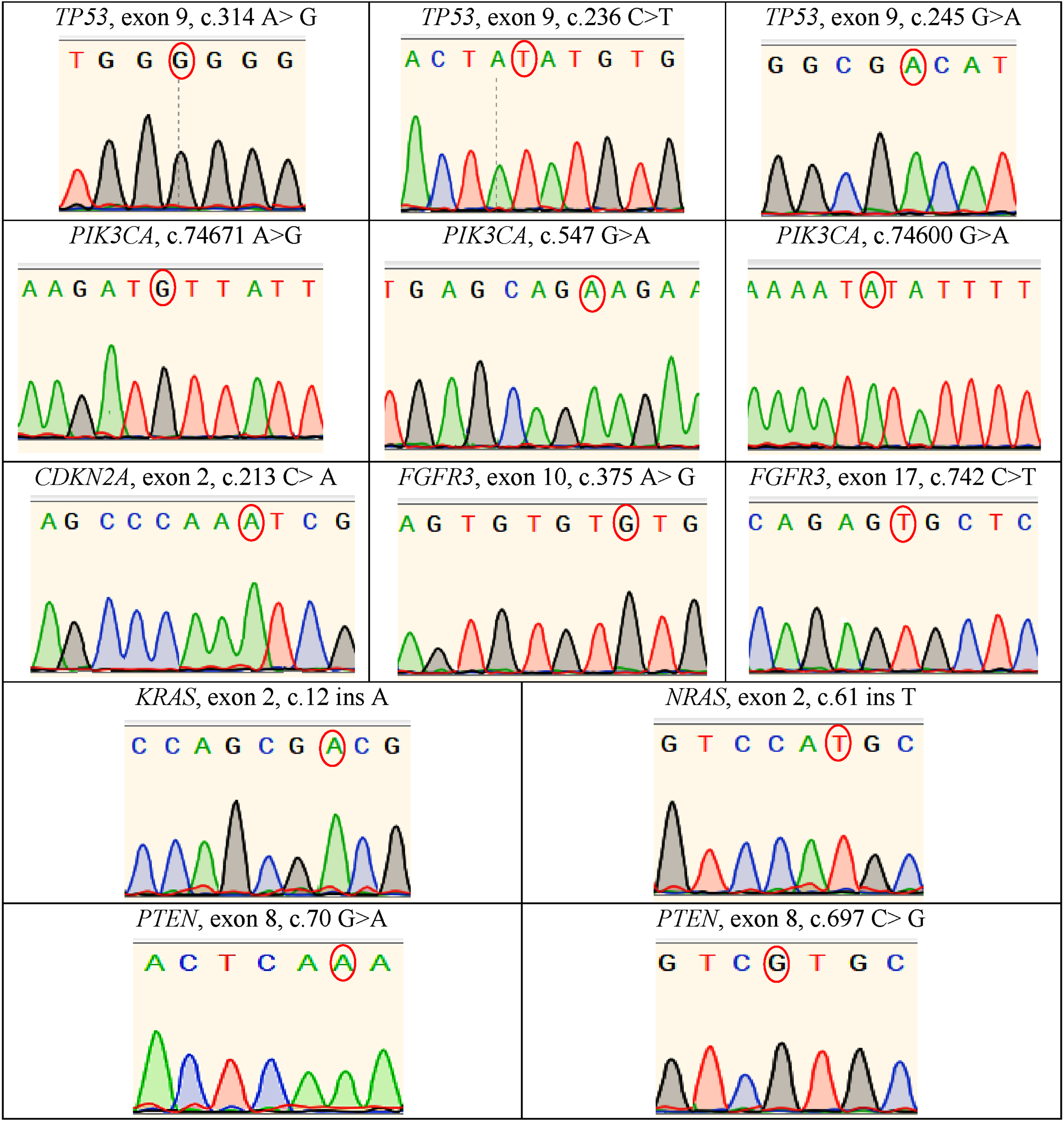 Electropherograms derived through the Sanger sequencing technique indicated of biological mutations in such genes as TP53, CDKN2A, PIK3CA, FGFR3, NRAS, KRAS and PTEN genes.