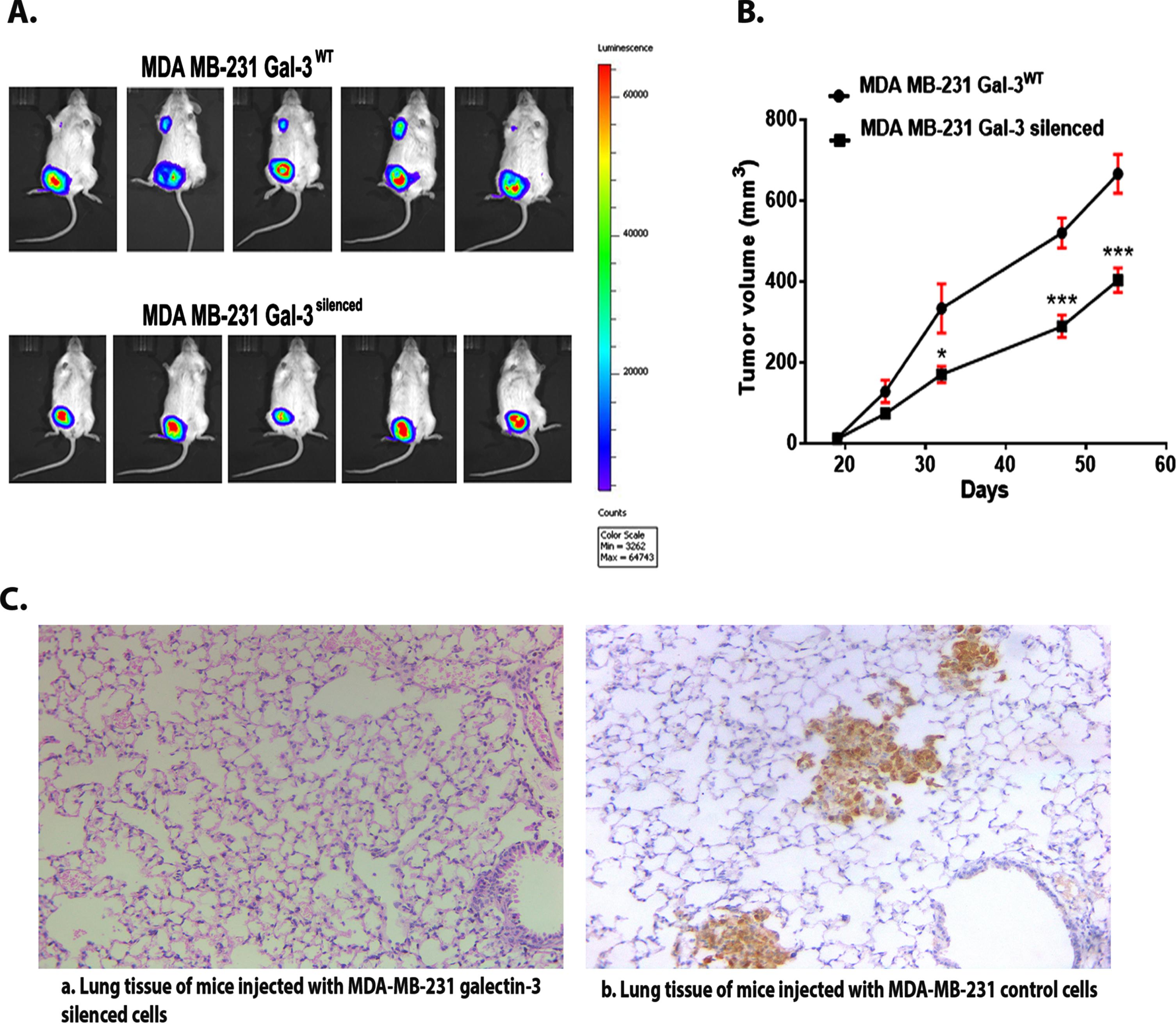 A. Real-time imaging of mice using IVIS system confirms the presence of metastatic tumor in control group compared to silenced group. B. Tumor growth curve: Quantitative evaluation of in vivo tumor growth in SCID/NOD mice. Data are expressed as means±SD (B) and are representative of two independent experiments; n = 5 each. The criteria for significance were p < 0.05 (*), p < 0.01 (**), and p < 0.001 (***) and ns means no statistical significance. C. The figure (a) shows IHC image of lung tissue containing no metastatic deposits from mice injected with MDA-MB-231 galectin-3-silenced cells (b) shows IHC image of lung tissue containing the metastatic cells from mice injected with MDA-MB-231 galectin-3-expressing cells (Magnification = 10 X).