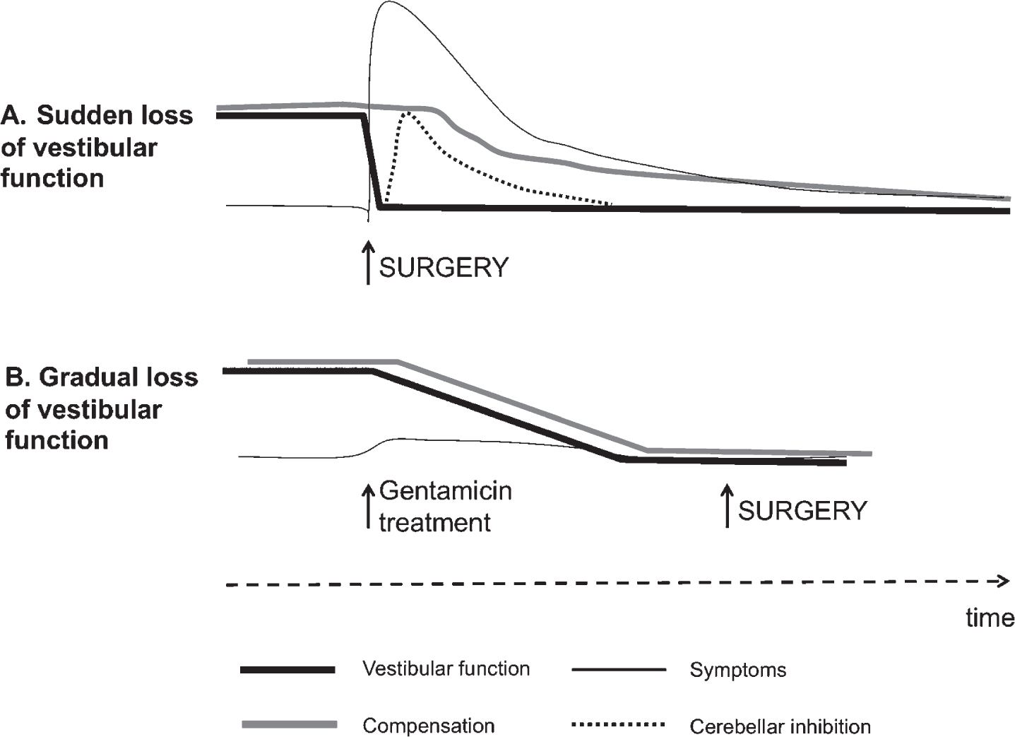 Theory behind the vestibular PREHAB protocol. In A, an abrupt deafferentation cause intense vestibular symptoms initially that gradually subsides as the cerebellar inhibition develops. Compensation becomes delayed as a consequence due to the inhibition as well as from the intensity of symptoms. In B. the vestibular function gradually attenuates with little or no symptoms allowing compensation to ensue unimpeded.