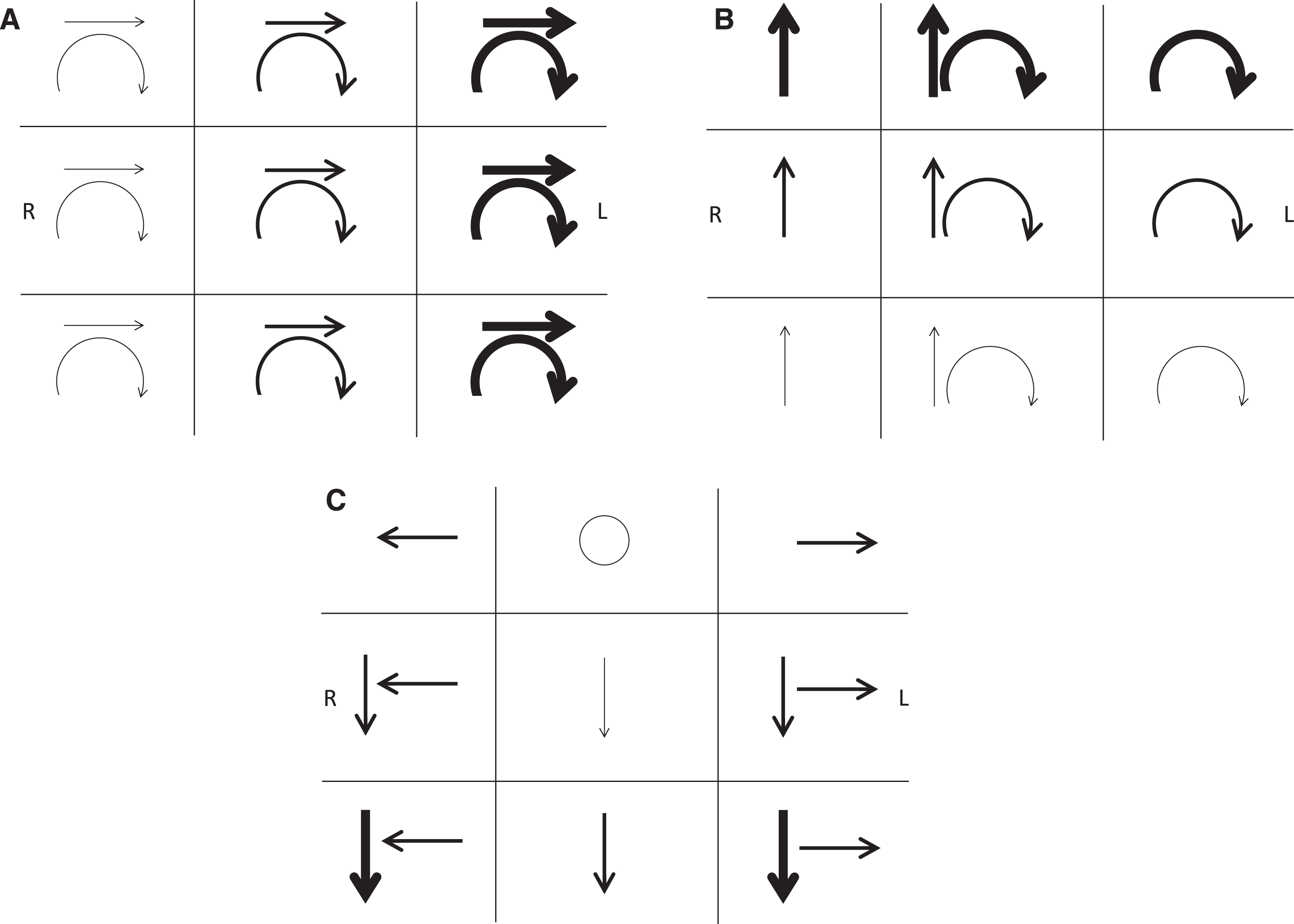 Jerk nystagmus schematic notation. Representing the important attributes of three-dimensional eye movements on a two-dimensional page presents several challenges requiring care to avoid ambiguity. As with describing nystagmus, its schematic notation should document the direction and intensity in the 9 cardinal gaze positions. If the nystagmus is not conjugate, each eye’s characteristics can be documented separately. By convention, eye movements are drawn from the vantage point of the examiner in front of the patient. Text should indicate whether arrows represent the slow or fast phase direction. In A-C, the arrows denote the direction of the fast phases, with the boldness of the arrows reflecting the intensity of the nystagmus. The frame of reference must be specified in every schematic in order to clarify whether the arrows for a given gaze position refer to eye movements being described in head-fixed coordinates (as viewed face to face with the patient) or eye-fixed coordinates (as viewed along the patient’s visual axis). The frame of reference that most efficiently describes a given pathologic nystagmus is typically the one most closely linked to the mechanism or site causing the nystagmus. Examples are shown: (A) Spontaneous third-degree horizontal-torsional left-beating peripheral vestibular nystagmus. This mixed horizontal-torsional nystagmus in straight-ahead gaze that obeys Alexander’s law (increases when looking in the fast phase direction and decreases when looking in the slow phase direction) is typical for an uncompensated right unilateral vestibular lesion. In this case the nystagmus directional arrows are in head-referenced coordinates, reflecting the combined effect of injury to all three semicircular canals and producing nystagmus that remains in a fixed direction with respect to the head and labyrinths regardless of gaze position (see Fig. 3). (B) Left posterior semicircular canal benign paroxysmal positional nystagmus. Nystagmus elicited in the left Dix-Hallpike position consists of mixed upbeat and torsional nystagmus with the upper pole of the eyes beating toward the left ear in straight-ahead gaze. Since the nystagmus direction is fixed in the plane of the left posterior canal, it appears predominantly vertical in rightward gaze and predominantly torsional in leftward gaze when observed along the patient’s visual axis (as documented in each box representing eye-referenced coordinates in this schematic), as well as obeying Alexander’s law. Note that the torsional fast phases could be confusingly described as clockwise from the examiner’s perspective (incorrect, but commonly used) but counterclockwise from the patient’s perspective (correct, but inconsistently used). (C) Spontaneous downbeat and bilateral gaze-holding nystagmus. Low-intensity pure downbeat nystagmus in straight-ahead gaze increases in lateral and downgaze and is associated with pathologic bilateral gaze-holding nystagmus. This schematic uses head-referenced coordinates, indicating that the downbeat component appears to remain fixed to labyrinthine coordinates regardless of gaze position. This may imply that the downbeat nystagmus is coming from a vestibular tone imbalance of the vertical rotational vestibulo-ocular reflex.