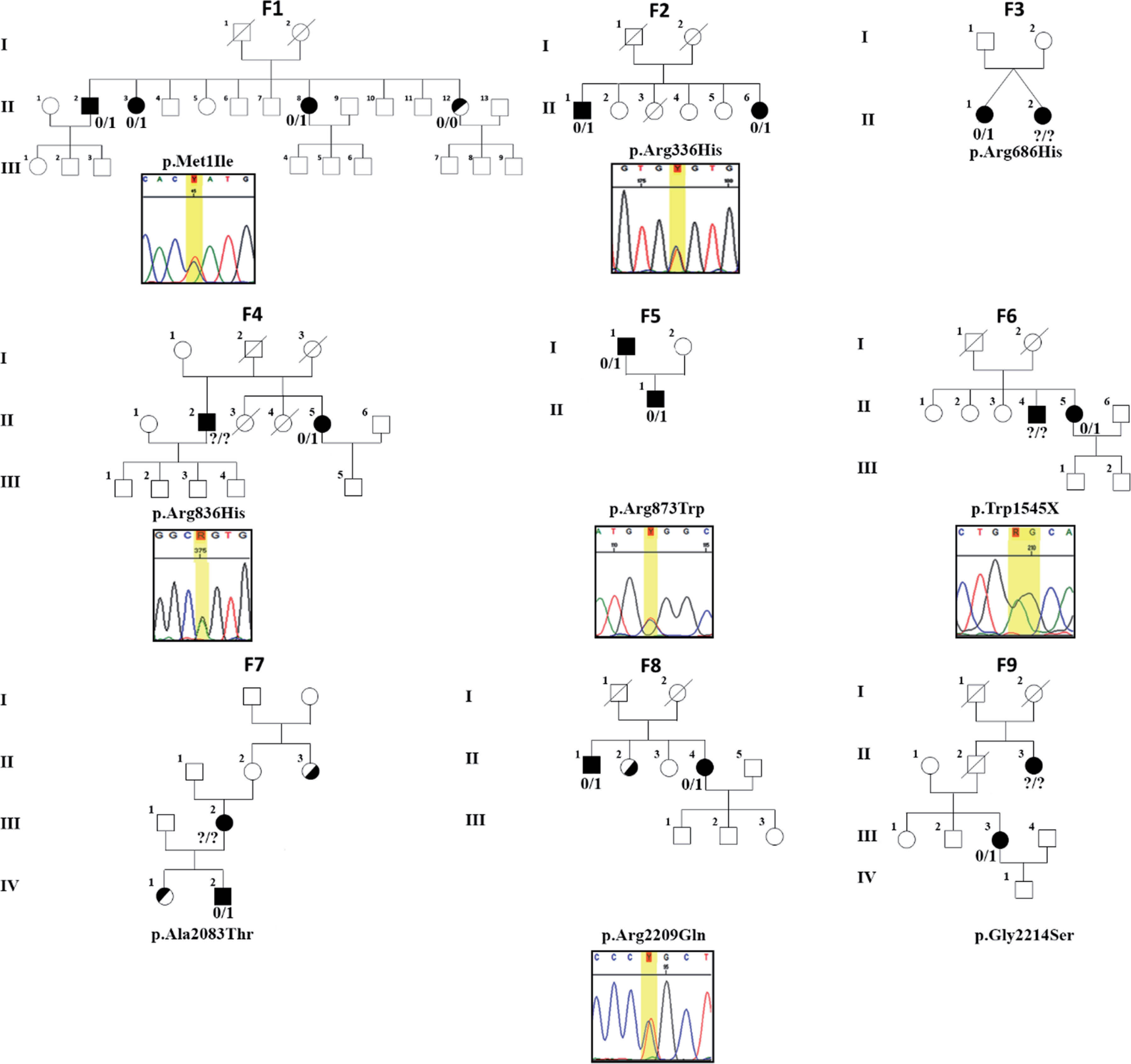 Nine MD families carrying rare variants in the MYO7A gene. Variants in MYO7A found in this study indicated by protein nomenclature and Sanger sequencing chromatograms are displayed under each family. Solid squares (male) and circles (female) indicate patients with definite MD. Those patients with only vertigo or hearing loss are indicated, respectively, with the upper or the lower half of their symbols filled. “0/1”: heterozygous variant. “0/0”: homozygous for the reference allele. “?/?”: Sample not available.