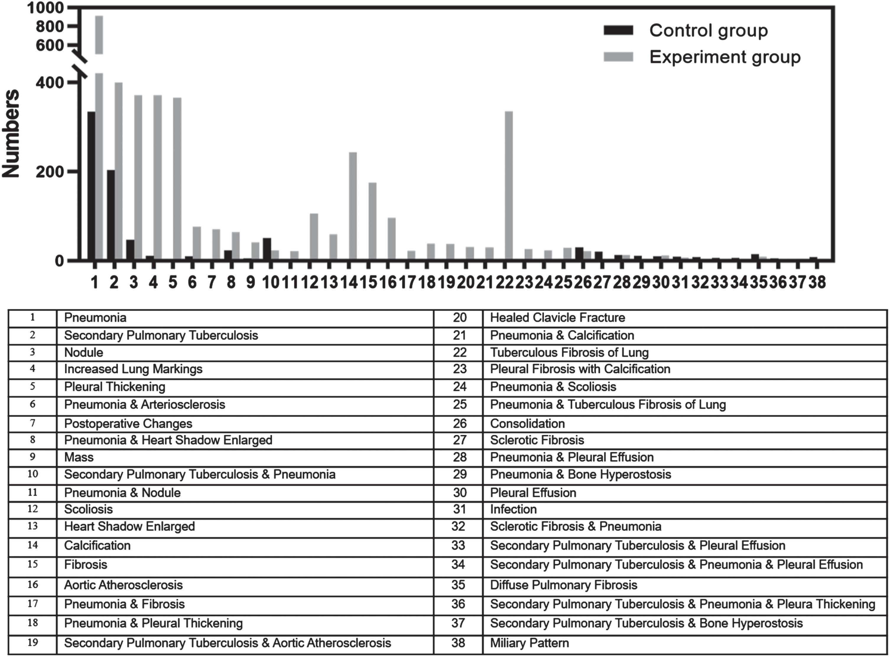 Distribution of top 25 classes of abnormalities on report conclusion-level for both the control and experiment groups. The two groups had 12 common conclusions (overlapped gray and black bars), resulting in a total of 38 classes of abnormalities (38 = 2*25–12). Among those 38 classes, class 34 and 36 consist of three different abnormalities (secondary pulmonary tuberculosis, pneumonia, and pleural effusion for class 34 and secondary pulmonary tuberculosis, pneumonia, and pleural thickening for class 36) and the rest of the 36 classes consist of either 1 or 2 abnormalities.