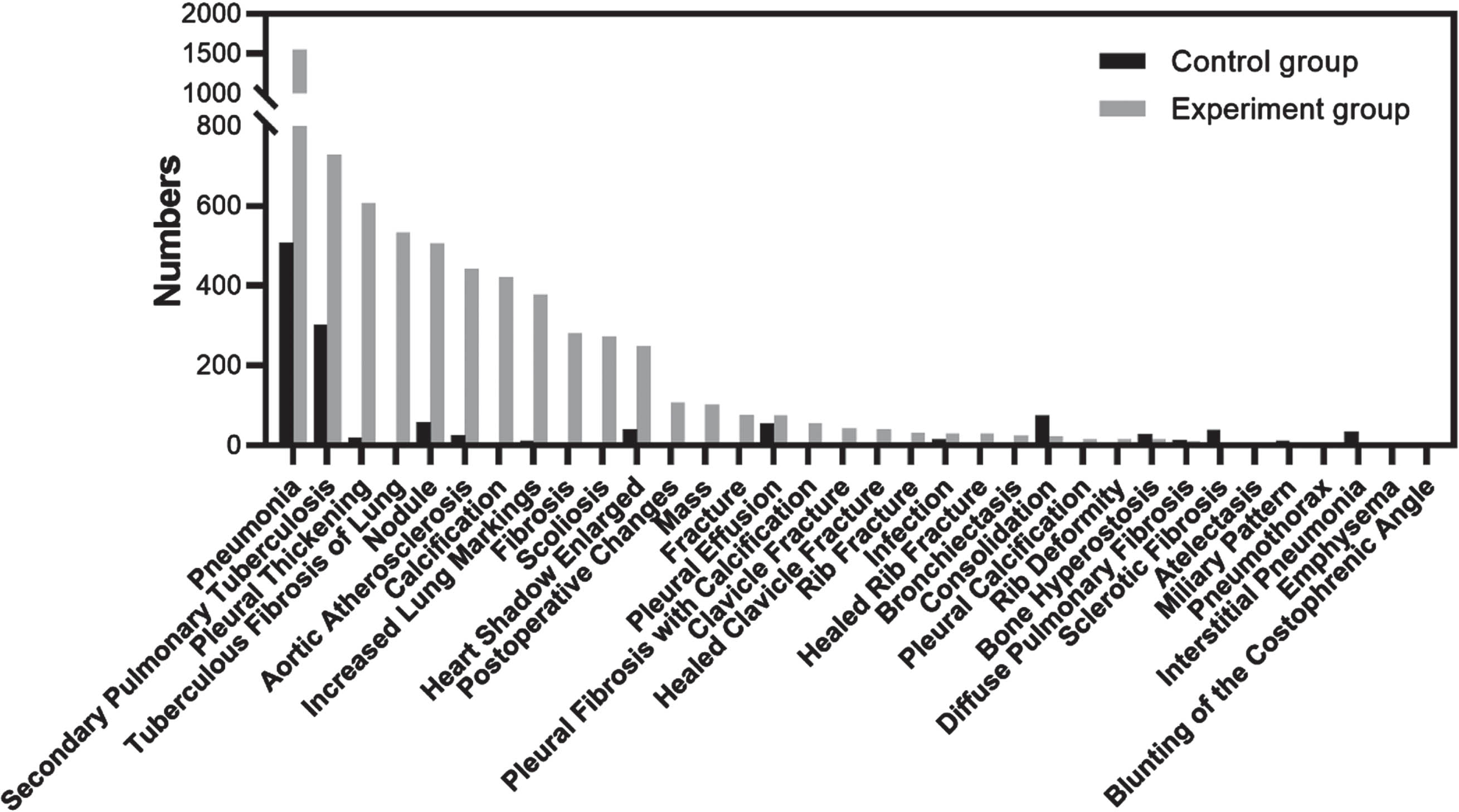 Distribution of the top 25 classes of abnormalities on ROI-level for both the control and experiment groups. The two groups had 16 common abnormalities (overlapped gray and black bars), resulting in a total of 34 classes of abnormalities (34 = 2*25–16).