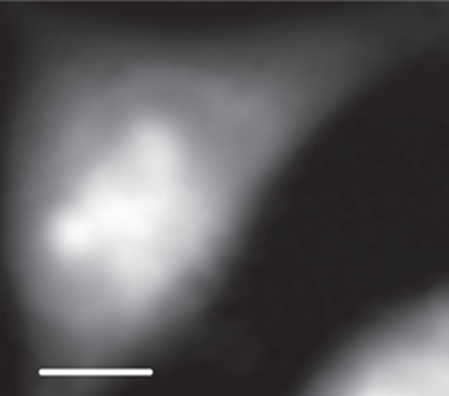 STXM image of an interphase CHO cell at 398 eV. The scale bar is 5μm.
