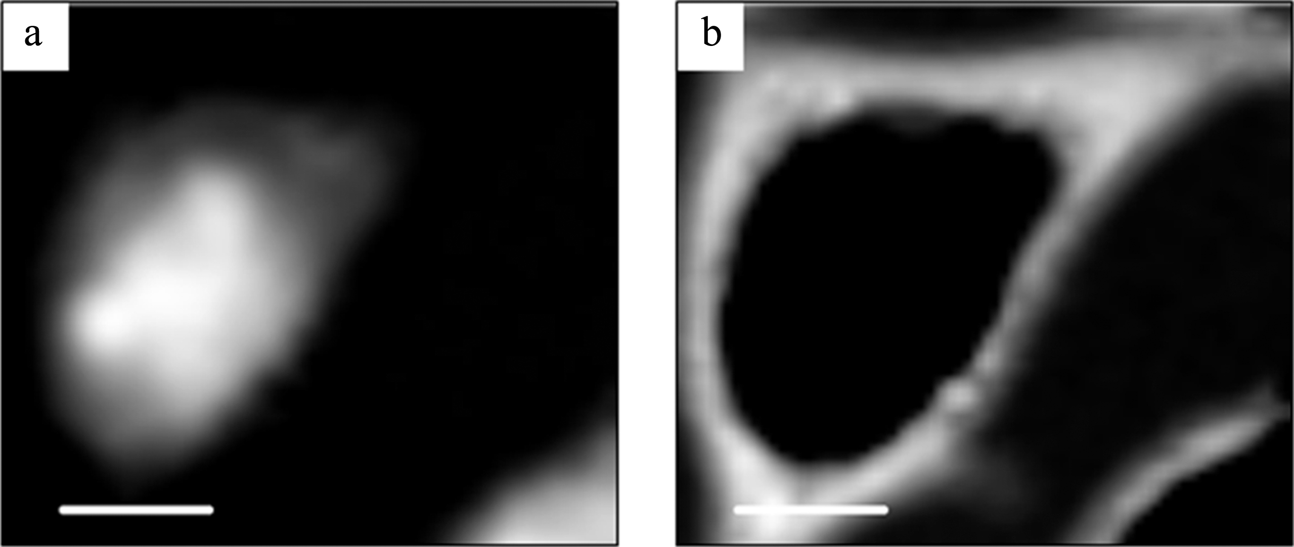 DNA (a) and RNA (b) images obtained by the SVD method in aXis2000 program. The scale bar is 5μm.
