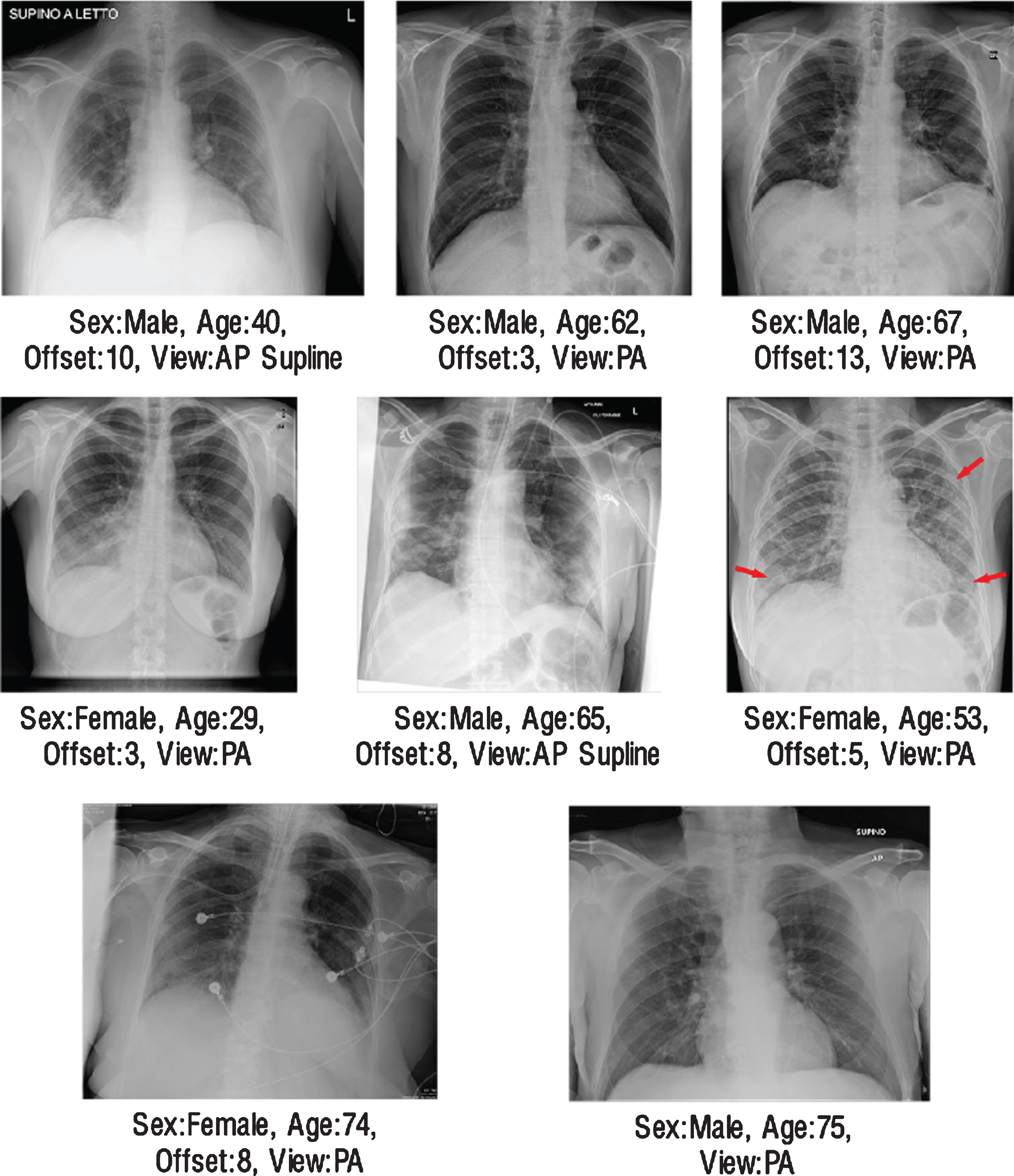 The illustration of radiographs where all networks made same mistakes.