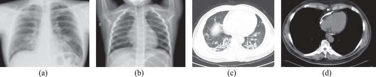 Medical image samples (a) COVID-19 X-ray (b) Non-COVID-19 X-ray (c) COVID-19 CT Scan (d) Non-COVID-19 CT Scan.