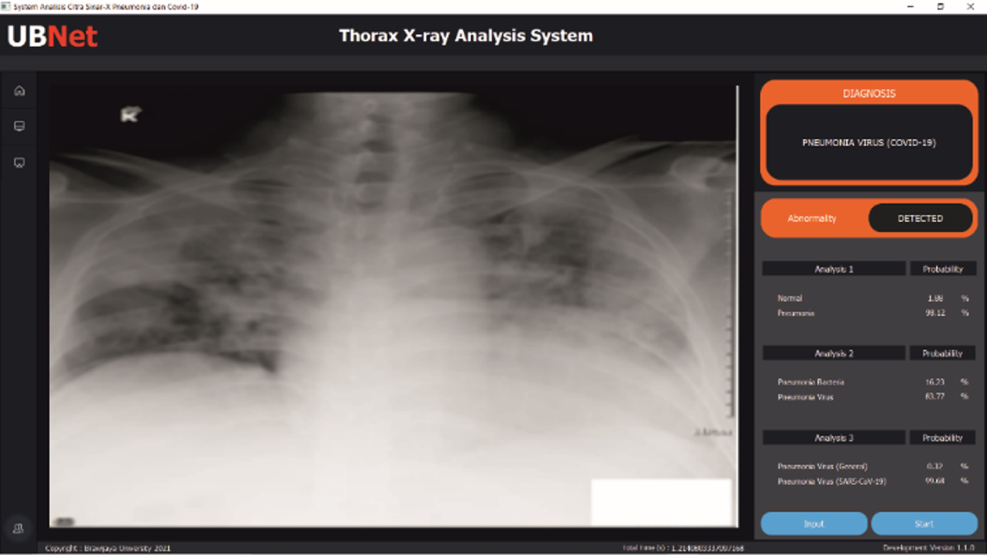 Results of chest X-ray analysis of local COVID-19 patients.