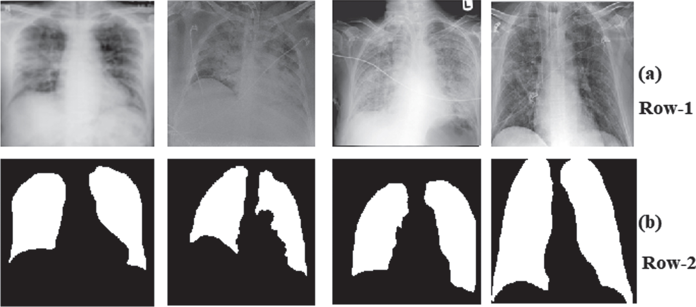 Sample dataset (a) Row-1: COVID-19 CXR images (b) Row-2: Ground-truth images.