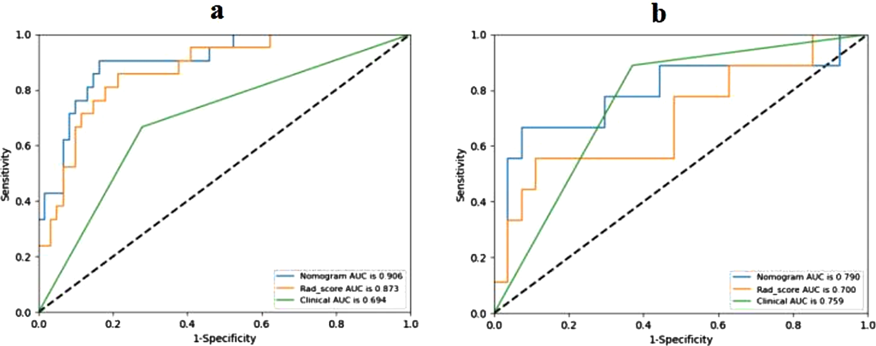 Receiver operating characteristic (ROC) curves of Rad-score, clinical model and radiomics nomogram in the training (a) and validation (b) cohorts.