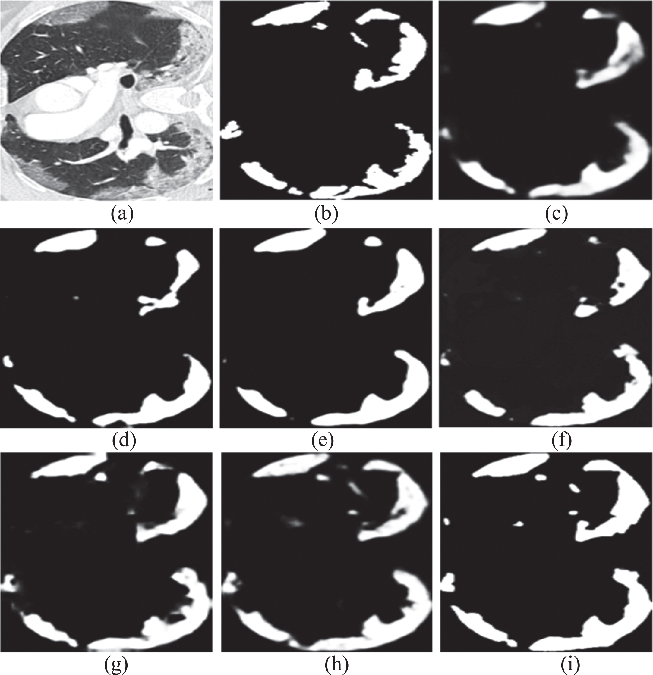 Segmenting results of a COVID-19 CT scan from testing set using different methods. (a) Raw CT scan; (b) Ground truth; (c) UNet, (d) UNet++, (e) Att-UNet, (f) Dense-UNet, (g) Inf-Net, (h) COPLE-Net, and (i) DAF-UNet.