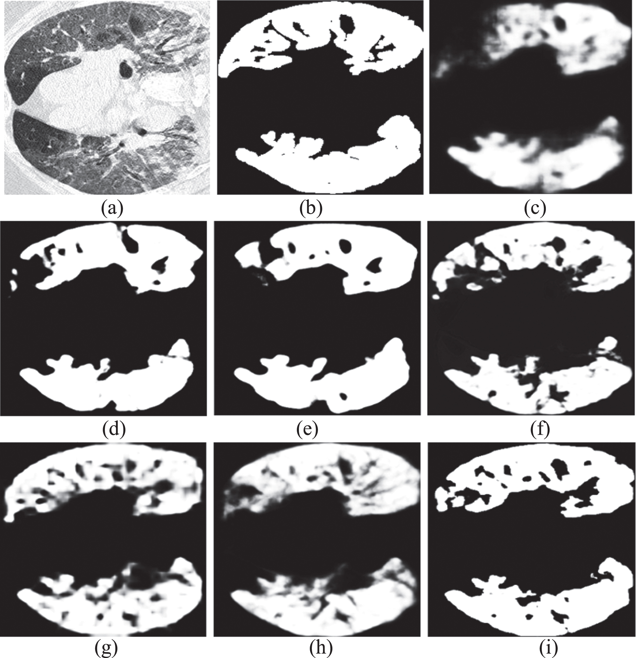 Segmenting results of another COVID-19 CT scan from testing set using different methods. (a) Raw CT scan; (b) Ground truth; (c) UNet, (d) UNet++, (e) Att-UNet, (f) Dense-UNet, (g) Inf-Net, (h) COPLE-Net, and (i) DAF-UNet.